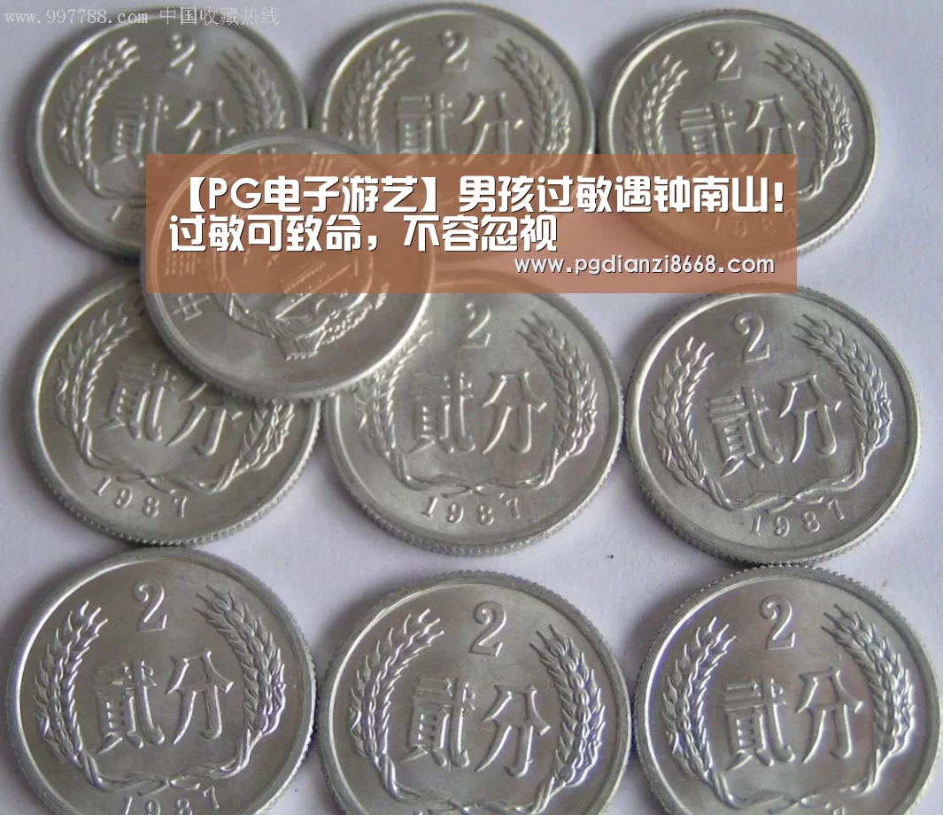 【PG电子游艺】男孩过敏遇钟南山!过敏可致命,不容忽视(图1) PG麻将平台